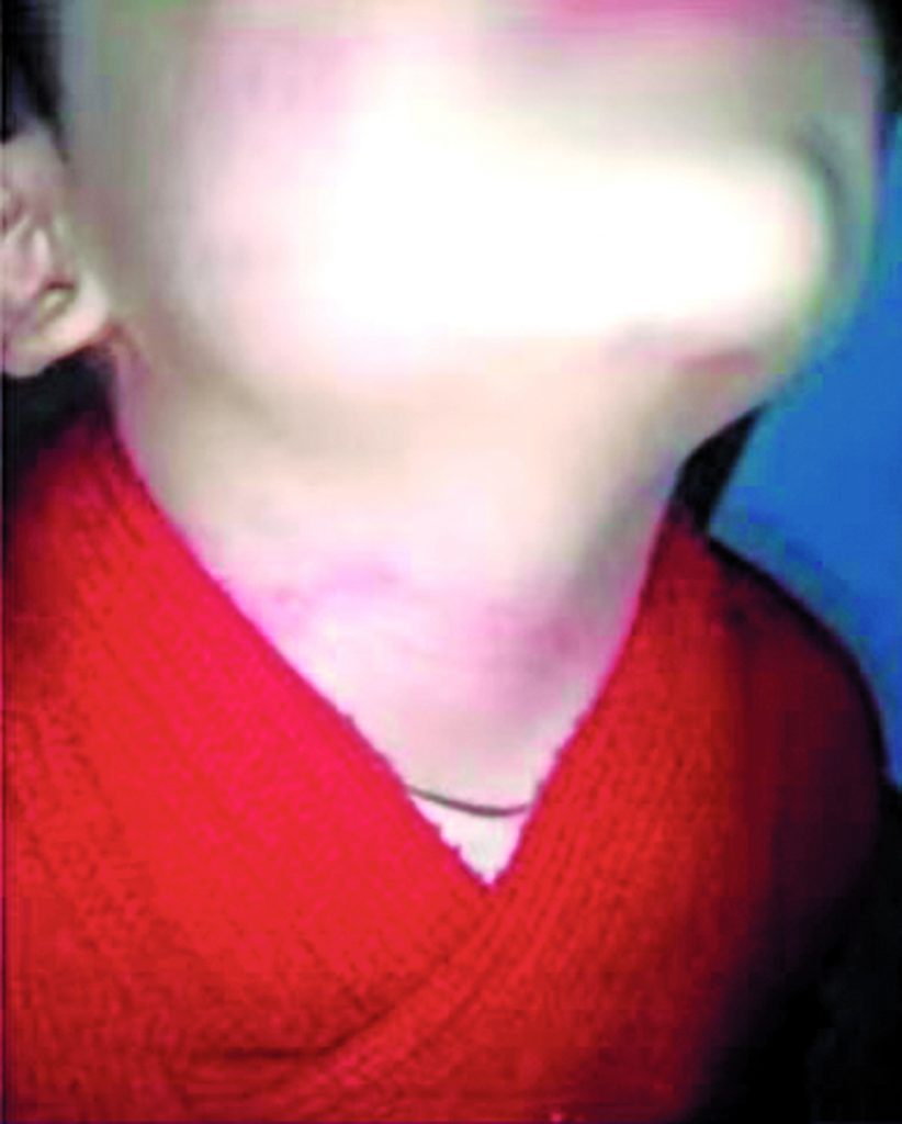 Denuncia que su nieto fue agredido por la mamá y el padrastro 1 Denuncia que su nieto fue agredido por la mamá y el padrastro Dentro de todos los aterradores relatos que por estos días registramos en Bogotá, en las últimas horas una abuelita dio un aterrador testimonio: su nieto habría sido blanco de terribles agresiones y golpizas de las manos de su propia madre y su padrastro.