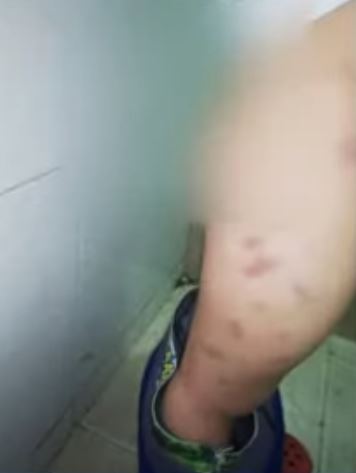 Denuncia que su nieto fue agredido por la mamá y el padrastro 2 Denuncia que su nieto fue agredido por la mamá y el padrastro Dentro de todos los aterradores relatos que por estos días registramos en Bogotá, en las últimas horas una abuelita dio un aterrador testimonio: su nieto habría sido blanco de terribles agresiones y golpizas de las manos de su propia madre y su padrastro.
