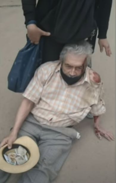 Anciano en bicicleta fue arrollado por ambulancia 3 Anciano en bicicleta fue arrollado por ambulancia Repudio e indignación ha causado un video que rueda por las redes sociales, en el que se ve el momento en el que una ambulancia atropella a un adulto mayor de 85 años que se movilizaba en bicicleta por una calle del sur de la ciudad.