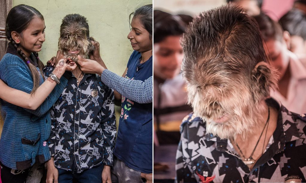 Así es la vida del ‘Niño lobo’ en la India Diariamente salen noticias impactantes de todos los rincones del mundo que no dejan y nunca dejarán de sorprendernos y dejarnos atónitos. La de hoy, por ejemplo, viene del inhóspito país de la India, una nación con más de cuatro mil millones de personas llena de sorprendentes e insólitas historias.