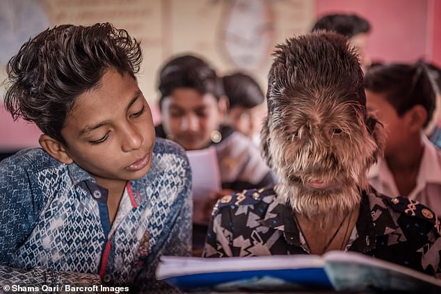 Así es la vida del ‘Niño lobo’ en la India Diariamente salen noticias impactantes de todos los rincones del mundo que no dejan y nunca dejarán de sorprendernos y dejarnos atónitos. La de hoy, por ejemplo, viene del inhóspito país de la India, una nación con más de cuatro mil millones de personas llena de sorprendentes e insólitas historias.