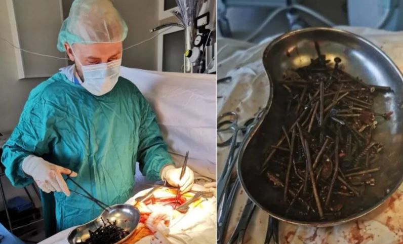¡Insólito! Se comió tornillos y clavos cuando dejó el alcohol 2 ¡Insólito! Se comió tornillos y clavos cuando dejó el alcohol Médicos lituanos informaron en los últimos días que encontraron un kilogramo de clavos y tornillos dentro del estómago de un hombre que empezó a engullir objetos metálicos tras dejar de beber alcohol.