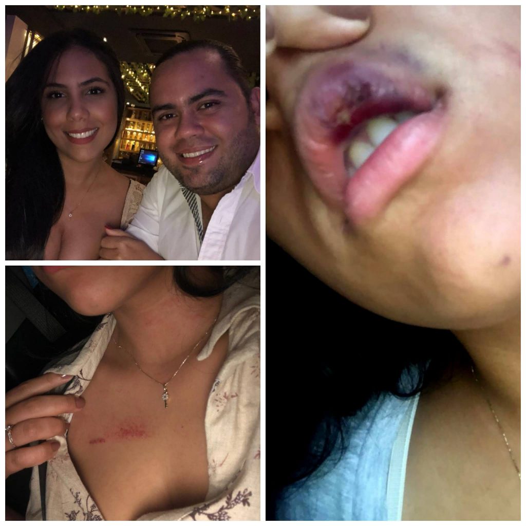Rey Vallenato es señalado de maltrato a su expareja José Ricardo Villafañe se coronó Rey Vallenato 2021 el pasado lunes 18 de octubre, pero después de haber recibido elogios por su talento musical, ahora esta en el ojo del huracán por la denuncia de una mujer que lo acusa de haberla maltratado física y psicológicamente.