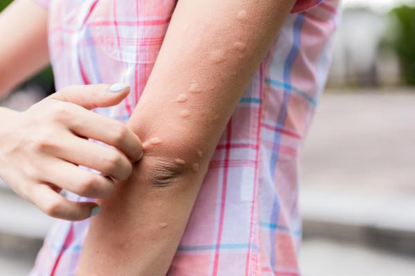 ¡Pilas con la amenaza del dengue! 4 ¡Pilas con la amenaza del dengue! Mientras Colombia parece estar dejando lo peor de la pandemia del COVID 19 atrás, hay otra enfermedad viral que está cobrando fuerza en el país y la cual, con varios repuntes en casos positivos, encendió las alarmas del Ministerio de Salud y de los especialistas en la materia.