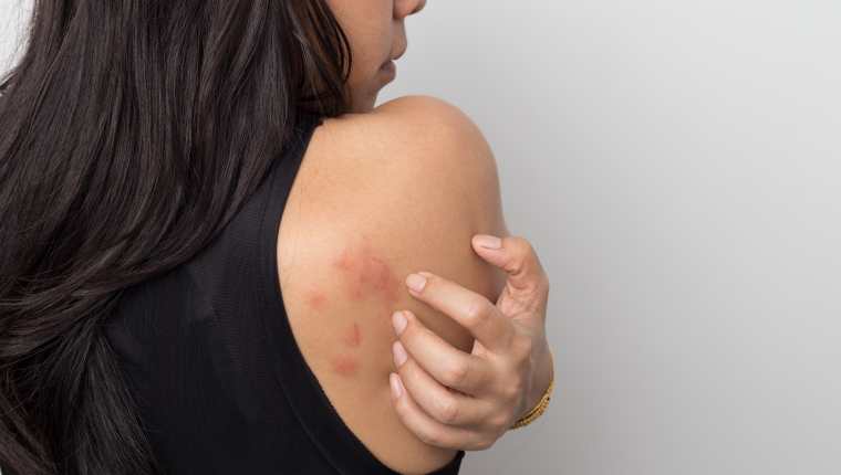¡Pilas con la amenaza del dengue! 6 ¡Pilas con la amenaza del dengue! Mientras Colombia parece estar dejando lo peor de la pandemia del COVID 19 atrás, hay otra enfermedad viral que está cobrando fuerza en el país y la cual, con varios repuntes en casos positivos, encendió las alarmas del Ministerio de Salud y de los especialistas en la materia.
