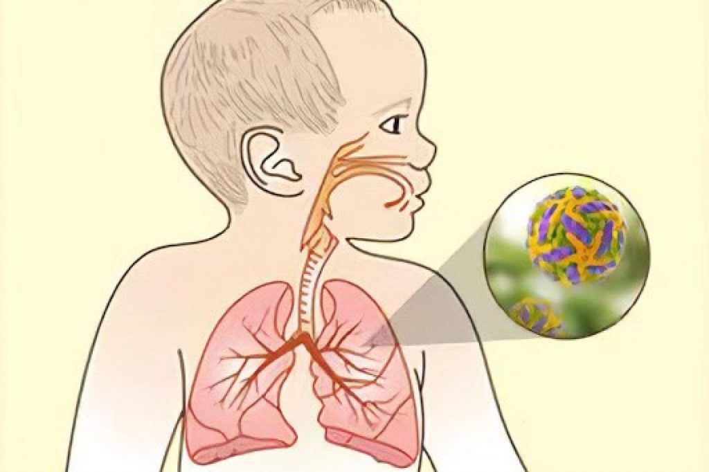 PÁRELE BOLAS A ESTE VIRUS En noviembre se celebra el Día Mundial del Prematuro y, como siempre, estas fechas son recordatorios para la prevención de enfermedades y cuidados en la salud.