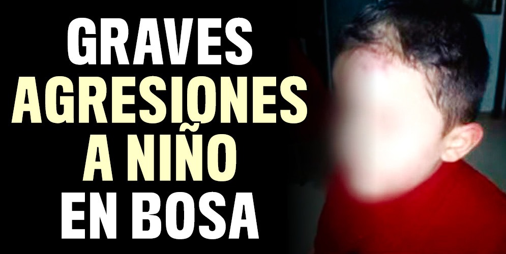 Denuncia que su nieto fue agredido por la mamá y el padrastro 9 Denuncia que su nieto fue agredido por la mamá y el padrastro Dentro de todos los aterradores relatos que por estos días registramos en Bogotá, en las últimas horas una abuelita dio un aterrador testimonio: su nieto habría sido blanco de terribles agresiones y golpizas de las manos de su propia madre y su padrastro.