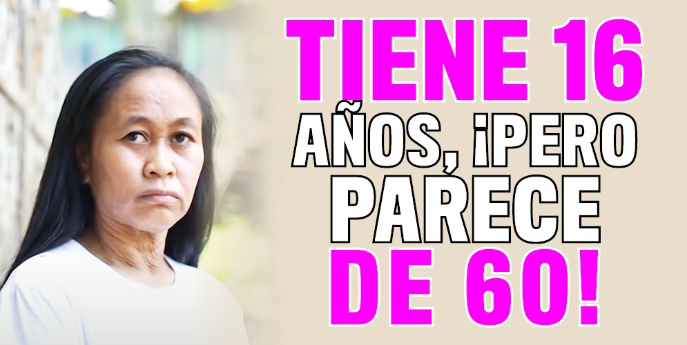 Raizel tiene 16 años, pero por una enfermedad parece de 60 4 Raizel tiene 16 años, pero por una enfermedad parece de 60 Raizel Calago es una filipina de 16 años, quien hace dos años comenzó a ver una rara transformación en su rostro y en cuerpo, todo por culpa de una extraña enfermedad que la ha perturbado.