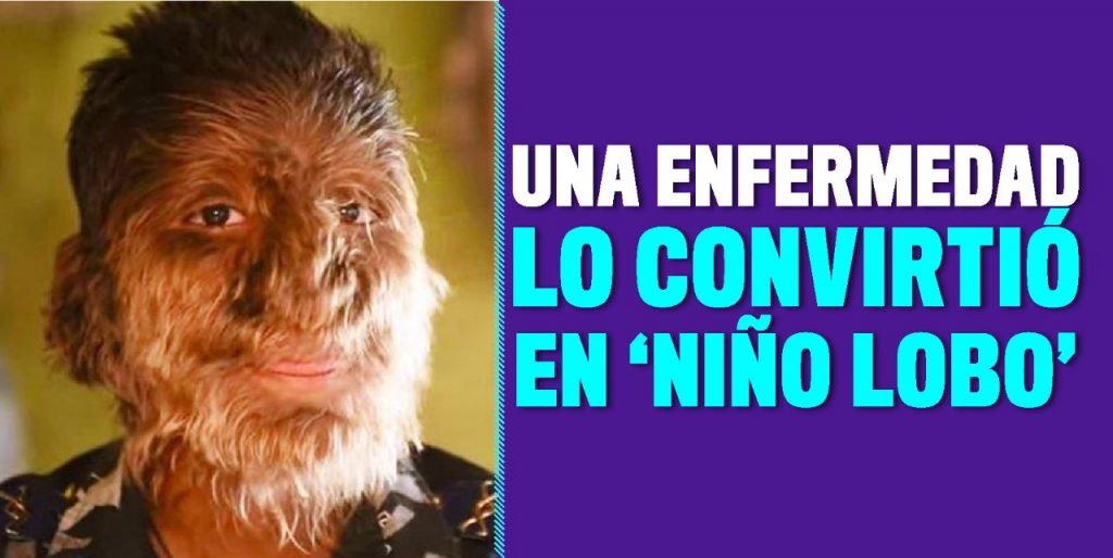 Así es la vida del ‘Niño lobo’ en la India 4 Así es la vida del ‘Niño lobo’ en la India Diariamente salen noticias impactantes de todos los rincones del mundo que no dejan y nunca dejarán de sorprendernos y dejarnos atónitos. La de hoy, por ejemplo, viene del inhóspito país de la India, una nación con más de cuatro mil millones de personas llena de sorprendentes e insólitas historias.