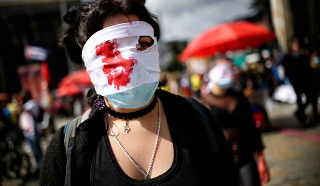 Al menos 103 víctimas de lesiones oculares en Paro Nacional 1 Al menos 103 víctimas de lesiones oculares en Paro Nacional Al menos 103 personas fueron víctimas de lesiones oculares del 28 de abril al 20 de julio de este año en el marco del Paro Nacional, como consecuencia de enfrentamientos con la Policía, según un informe de Amnistía Internacional, Temblores y el Programa de Acción por la Igualdad y la Inclusión Social (PAIIS) de la Universidad de los Andes.