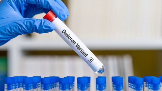 En Brasil confirman dos casos de la nueva variante Ómicron 3 En Brasil confirman dos casos de la nueva variante Ómicron La gobernación de Sao Paulo confirmó este martes dos casos positivos de la nueva variante de coronavirus Ómicron, los primeros en Brasil y en América Latina, en viajeros que llegaron desde Sudáfrica antes de que ese país anunciara el hallazgo de esa cepa en su territorio.