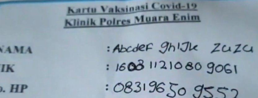 Se fue a vacunar y se reveló su extraño nombre: Abcdef Ghijk Nombres extraños de personas hay en todos los países. Y es que papás con exceso de creatividad o sin pena al qué dirán, se encargan de hacer con sus ocurrencias hechos que se viralizan en todo el mundo. Ese es el caso de un joven de Indonesia sobre quien le contamos a continuación.