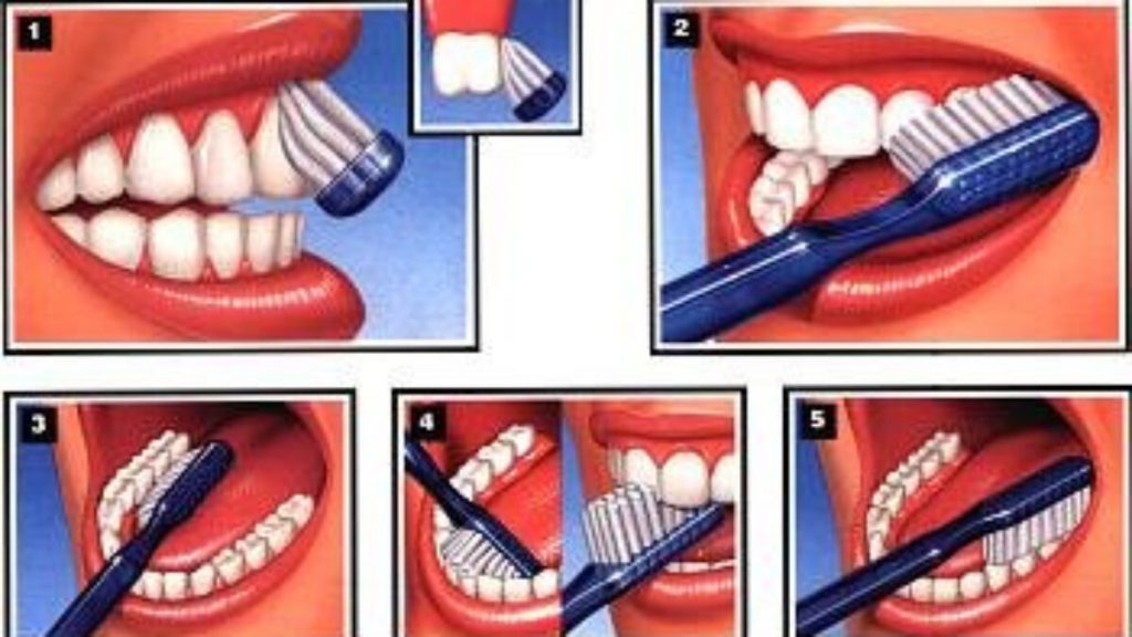SONRISA PROTEGIDA EN 5 MINUTOS La sonrisa es el reflejo de lo que somos y de qué tanto cuidado y salud aplicamos a nosotros mismos.