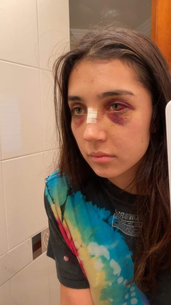 EN VIDEO. Camila denuncia salvaje agresión de su expareja 1 EN VIDEO. Camila denuncia salvaje agresión de su expareja En la últimas horas una joven de 24 años llamada Camila Alfaro hizo pública una fuerte denuncia a través de sus redes sociales, que en poco tiempo se hizo viral. En esta entrega su relato y muestra fuerte fotografías sobre el maltrato físico y verbal sufrido durante meses por su pareja.
