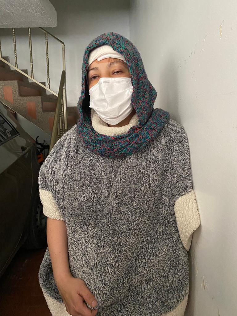 En un hurto una mujer recibió un disparo en la cabeza 1 En un hurto una mujer recibió un disparo en la cabeza “¡No tengo más nada!”, fue lo que dijo una vecina del barrio Aures II (Suba), de 38 años, luego de entregarle su bolso a dos maleantes que la estaban atracando en la esquina de su casa. Pero no contentos con esto, y al ver que la mujer gritaba del susto, uno de ellos accionó un arma traumática a la altura de su cabeza y a ‘quemarropa’. Un milagro de los cielos le permitió contarle a Q’HUBO su historia, que salió a la luz en las últimas horas.
