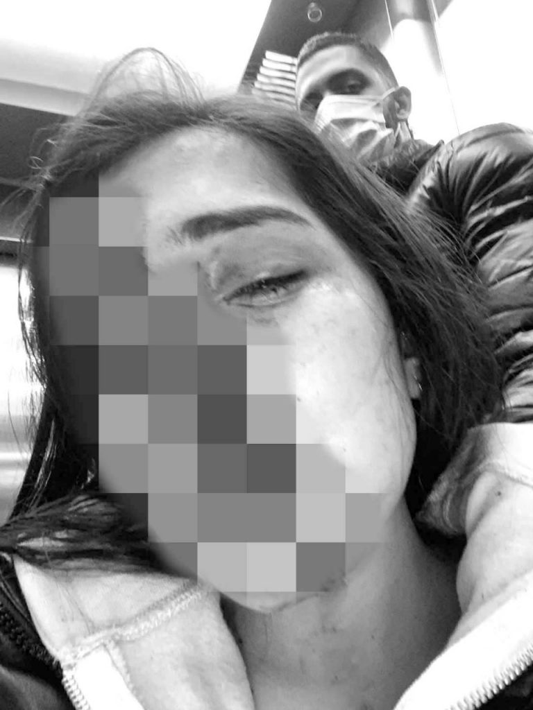 EN VIDEO. Camila denuncia salvaje agresión de su expareja 4 EN VIDEO. Camila denuncia salvaje agresión de su expareja En la últimas horas una joven de 24 años llamada Camila Alfaro hizo pública una fuerte denuncia a través de sus redes sociales, que en poco tiempo se hizo viral. En esta entrega su relato y muestra fuerte fotografías sobre el maltrato físico y verbal sufrido durante meses por su pareja.