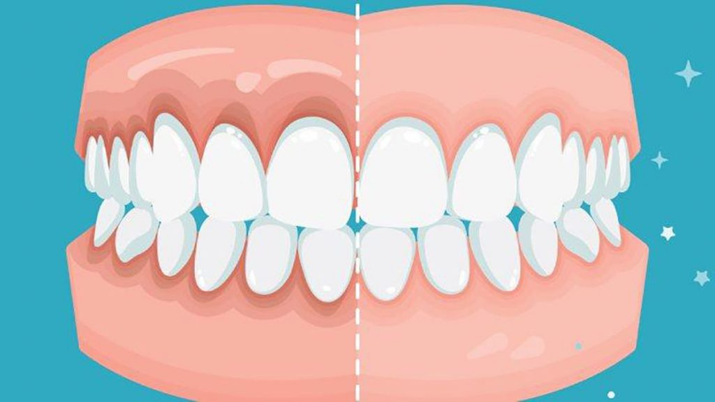 VIGILE LA SALUD DE SUS ENCÍAS 1 VIGILE LA SALUD DE SUS ENCÍAS La relación entre la salud bucodental, especialmente la enfermedad periodontal, y las enfermedades cardiovasculares han recibido una atención cada vez mayor en las últimas dos décadas.