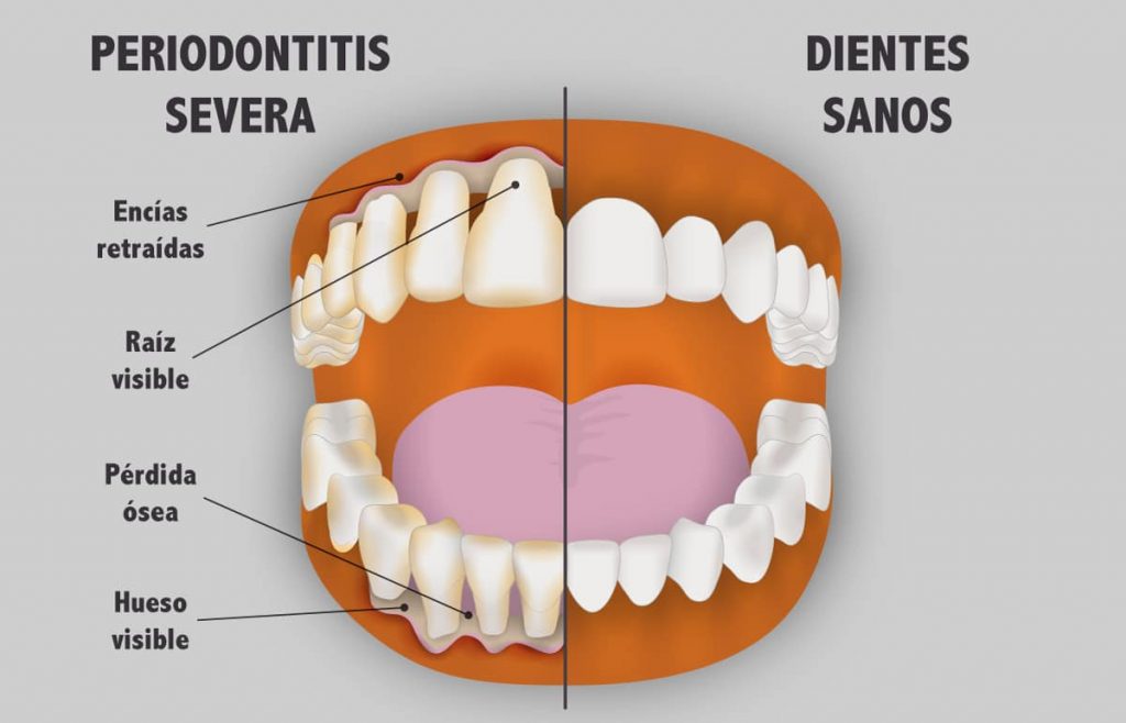 VIGILE LA SALUD DE SUS ENCÍAS 2 VIGILE LA SALUD DE SUS ENCÍAS La relación entre la salud bucodental, especialmente la enfermedad periodontal, y las enfermedades cardiovasculares han recibido una atención cada vez mayor en las últimas dos décadas.