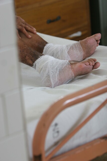 Cada año en Colombia se diagnostican 300 casos de lepra 1 Cada año en Colombia se diagnostican 300 casos de lepra El Ministerio de Salud informó que cada año 300 colombianos son diagnosticados con la enfermedad de Hansen (lepra), por eso la cartera de Salud lanzó una cartilla para pacientes con esta patología.