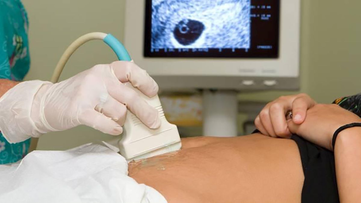 Vuelve y juega: decisión sobre aborto quedó empatada, llamarán a conjueces 2 Vuelve y juega: decisión sobre aborto quedó empatada, llamarán a conjueces La Sala Plena de la Corte Constitucional, nuevamente, no pudo llegar a un acuerdo en la decisión de la despenalización total del aborto en Colombia. Este jueves, tras la salida del magistrado Alejando Linares de la discusión de fondo, que eran las dos demandas que pedían sacar el delito del Código Penal, quedó empatada con una votación de 4-4 en cada caso.