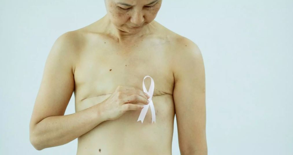A sobrevivientes al cáncer de mama se les reconstruirá ambos senos 1 A sobrevivientes al cáncer de mama se les reconstruirá ambos senos En las últimas horas el presidente Iván Duque sancionó la Ley 2194 ‘Reconstruyendo Sueños’, autoría del representante vallecaucano Juan Fernando Reyes Kuri, que busca garantizar la reconstrucción de ambos senos a las mujeres en Colombia que han sufrido cáncer de mama.