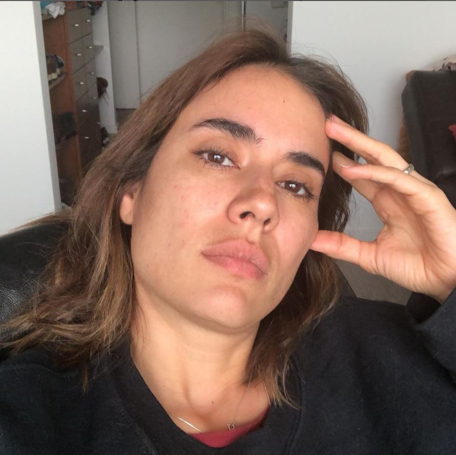 El incidente de Carolina Ramírez con su rostro La reconocida actriz Carolina Ramírez, quien protagonizó la exitosa serie 'La reina del flow' y ha estado en otras producciones como 'La hija del marichi', contó por medio de su red social Instagram un episodio que vivió por cuenta de una depilación casera en su rostro.