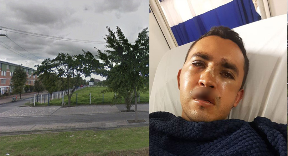 El drama de Michael por malditos ladrones en ciclorruta de Fontibón La violencia en medio de los atracos en Bogotá cada vez es más insoportable. Esta semana conocimos el caso de un joven trabajador y padre de familia de 31 años, quien hoy está postrado en la cama de un hospital tras ser atacado por dos ladrones. Estos maleantes no contentos con quitarle sus pertenencias, entre ellas su bicicleta, le dejaron graves traumas en el rostro y la cabeza.
