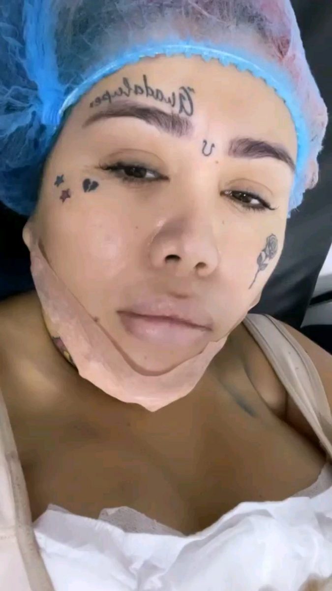 Yina Calderón sigue dando lora con sus cirugías La influencer Yina Calderón continúa dando de qué hablar. En las redes sociales se ha mostrado activa hablando sobre su recuperación, luego de haberse sometido a varios procedimiento estéticos con el fin de ser la ‘Barbie colombiana’, como ella misma se he denominado. 