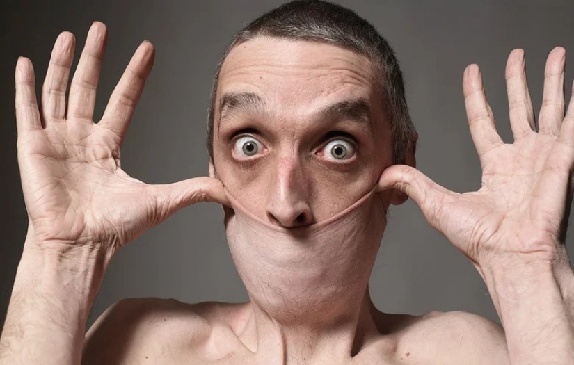 El increíble hombre de 'plastilina' 8 El increíble hombre de 'plastilina' Garry Turner es un británico que literalmente es famoso porque su piel parece de plastilina; de hecho, entró al Libro Guinness de los Récords el 29 de octubre de 1999 por ser el hombre con la piel más elástica del planeta.