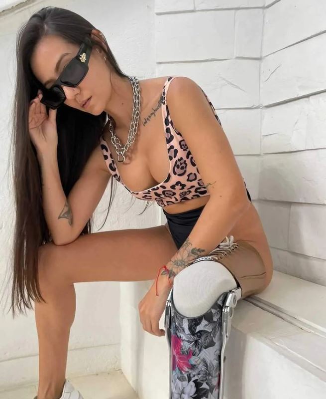 Tatiana Giraldo, la modelo que sin una pierna conquistó las pasarelas 2 Tatiana Giraldo, la modelo que sin una pierna conquistó las pasarelas Estando en el vientre de su mamá, la familia de Tatiana Giraldo sufrió un accidente. El episodio fue tan delicado que por eso ella nació con una malformación genética, la cual la trajo al mundo sin su pierna izquierda.