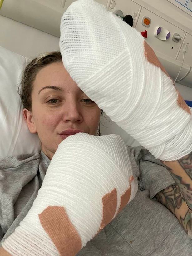 Sadie Kemp, la mujer que perdió todos los dedos de sus manos tras una infección Una joven en Inglaterra, llamada Sadie Kemp, sufrió de una infección y su vida cambió drásticamente cuando le tuvieron que amputar todos los dedos de sus manos.