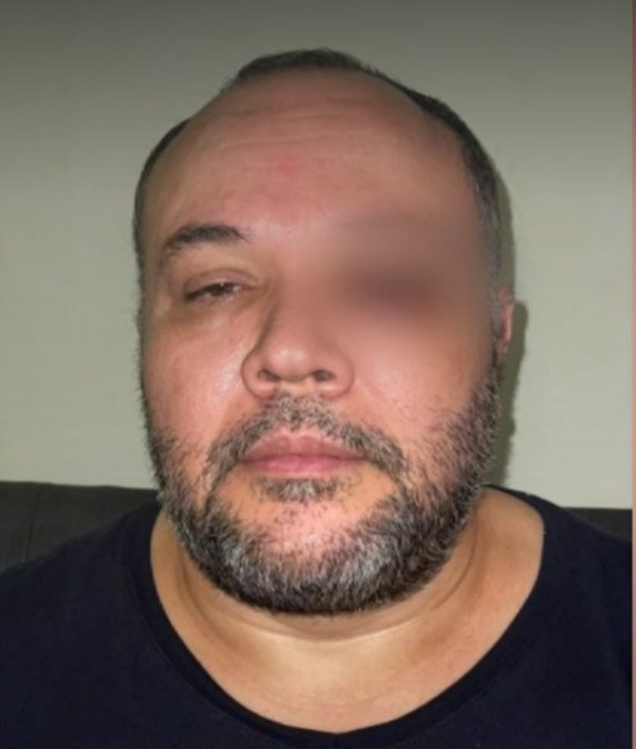 Médico término golpeado por no darle incapacidad a un paciente 1 Médico término golpeado por no darle incapacidad a un paciente El médico José Ricardo Mieles fue víctima de una brutal agresión por parte de un paciente que estaba atendiendo en el Hospital de Envigado, en Antioquia. Según indicó el profesional de la salud, fue golpeado debido a que se negó a darle la incapacidad que el paciente le pedía.
