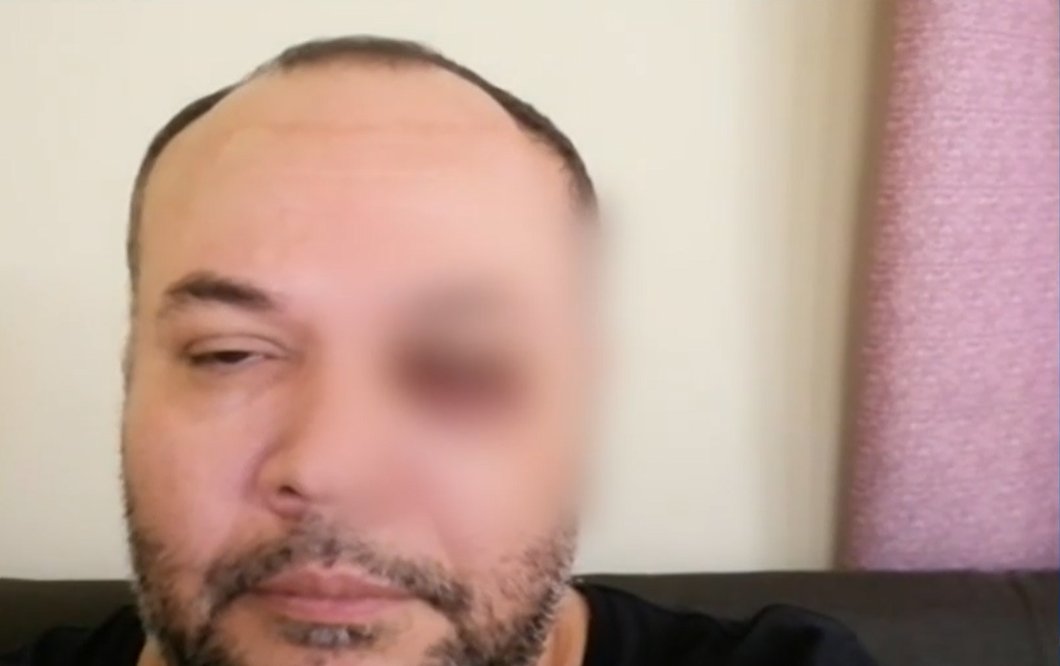Médico término golpeado por no darle incapacidad a un paciente 8 Médico término golpeado por no darle incapacidad a un paciente El médico José Ricardo Mieles fue víctima de una brutal agresión por parte de un paciente que estaba atendiendo en el Hospital de Envigado, en Antioquia. Según indicó el profesional de la salud, fue golpeado debido a que se negó a darle la incapacidad que el paciente le pedía.