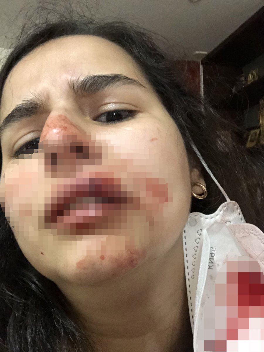 Joven denuncia que hija de Marbelle le dio tremendo golpe 9 Joven denuncia que hija de Marbelle le dio tremendo golpe Rafaella Chávez Ramírez, la hija de la reconocida cantante Marbelle, está envuelta en un gran polémica, pues una joven por medio de Twitter denuncia que fue agredida físicamente por parte de esta persona, y que teme por su vida y la de su familia.