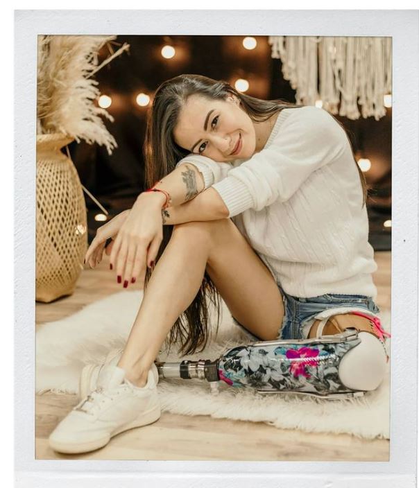Tatiana Giraldo, la modelo que sin una pierna conquistó las pasarelas 5 Tatiana Giraldo, la modelo que sin una pierna conquistó las pasarelas Estando en el vientre de su mamá, la familia de Tatiana Giraldo sufrió un accidente. El episodio fue tan delicado que por eso ella nació con una malformación genética, la cual la trajo al mundo sin su pierna izquierda.