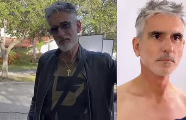 El cambio extremo de estos famosos colombianos A propósito de las cirugías de Miguel Varoni, Q'HUBO le recuerda a otros famosos criollos operados.