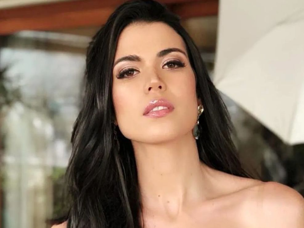 Miss Universo cuenta que una mala cirugía le arruinó el rostro La modelo, periodista y concursante de Miss Universo 2018, Andrea Díaz, contó cómo fue que por poco pierde el sueño de ser reina de belleza, pues debido a un procedimiento estético su rostro quedó con quemaduras muy notables.
