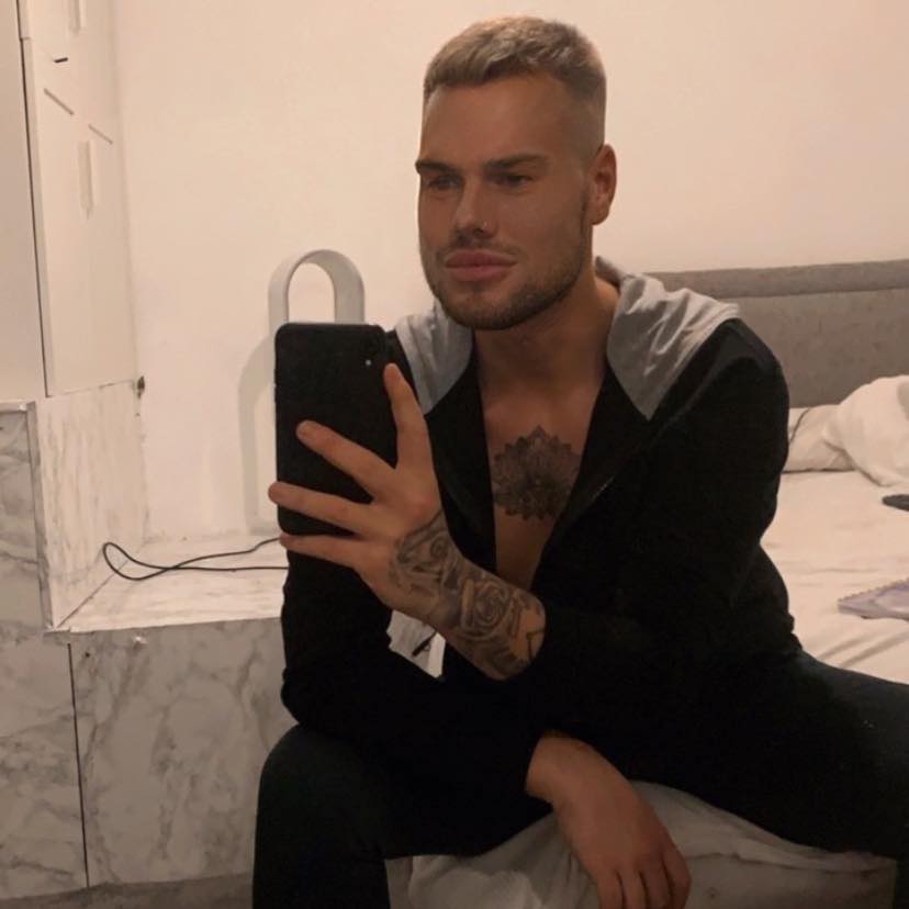 Se tiró un billetal para ser ‘bello’... y no es feliz 2 Se tiró un billetal para ser ‘bello’... y no es feliz Como a muchos jóvenes de hoy en día, Dale Saint Cullen, un británico de 28 años, se le ocurrió poner su vida y su cuerpo en manos de los cirujanos, pues se había obsesionado con los estándares de belleza que veía desde su computador y su teléfono, y estaba dispuesto a alcanzar por ese medio su felicidad.