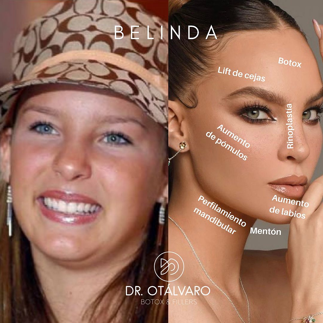 Médico boleteó los retoquitos de varias famosas... ¡vea el antes y el ahora! Hay famosas que uno sabe que cualquier retoque tienen, pues las fotos del antes y después las delatan.