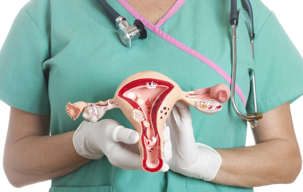 50 años de lucha contra el cáncer de cuello uterino La Liga Contra el Cáncer seccional Bogotá conmemora 50 años de lucha contra el cáncer de cuello uterino, mal considerado como el cuarto tumor que más ataca a mujeres en los últimos años.