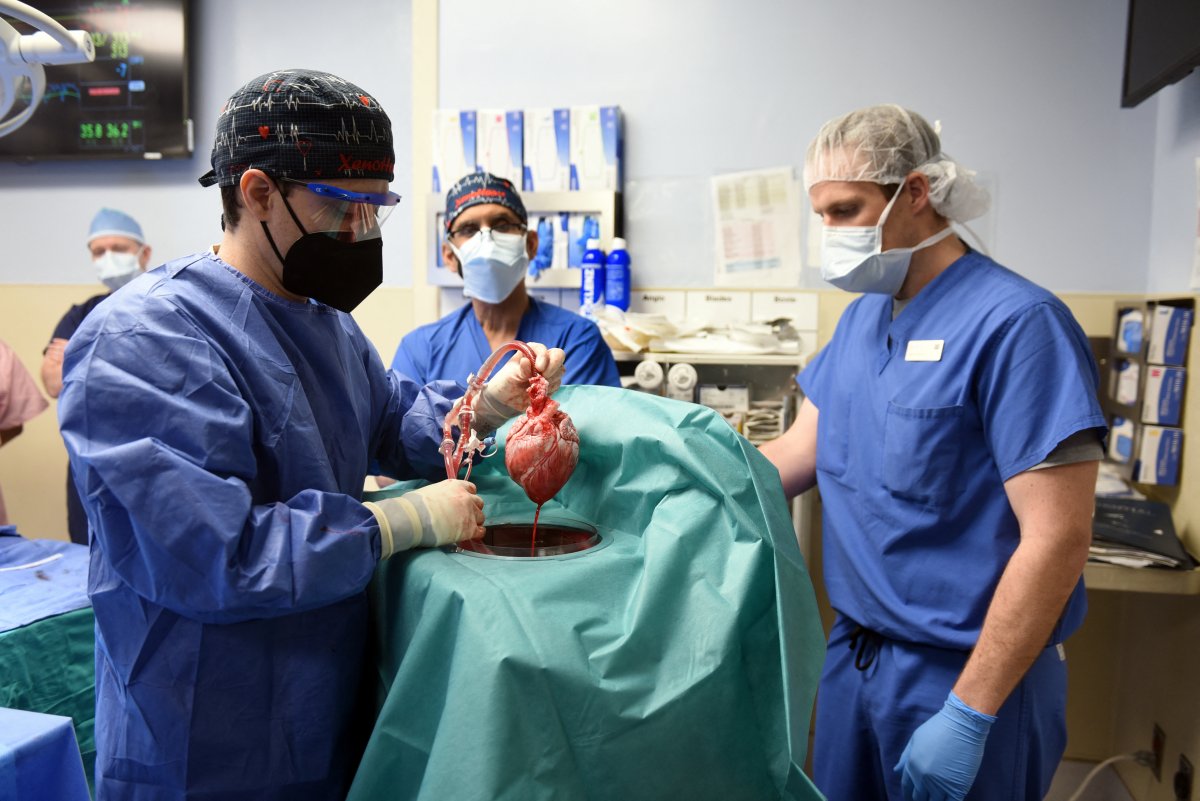 Muere el primer paciente que recibió trasplante de corazón de cerdo 1 Muere el primer paciente que recibió trasplante de corazón de cerdo La primera persona que recibió un trasplante de corazón de cerdo murió dos meses después del histórico procedimiento en Estados Unidos, informó este miércoles el hospital que llevó a cabo la cirugía.