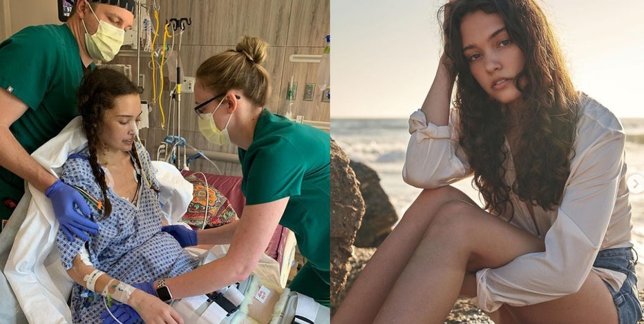 A modelo le amputaron las piernas por complicaciones de COVID-19 10 A modelo le amputaron las piernas por complicaciones de COVID-19 Claire Clurby Bridges, una joven de 21 años, que es modelo en Florida, Estados Unidos, luego de contraer COVID-19 y, debido a complicaciones por una afección cardíaca grave con la que nació, debieron amputarle sus dos piernas.