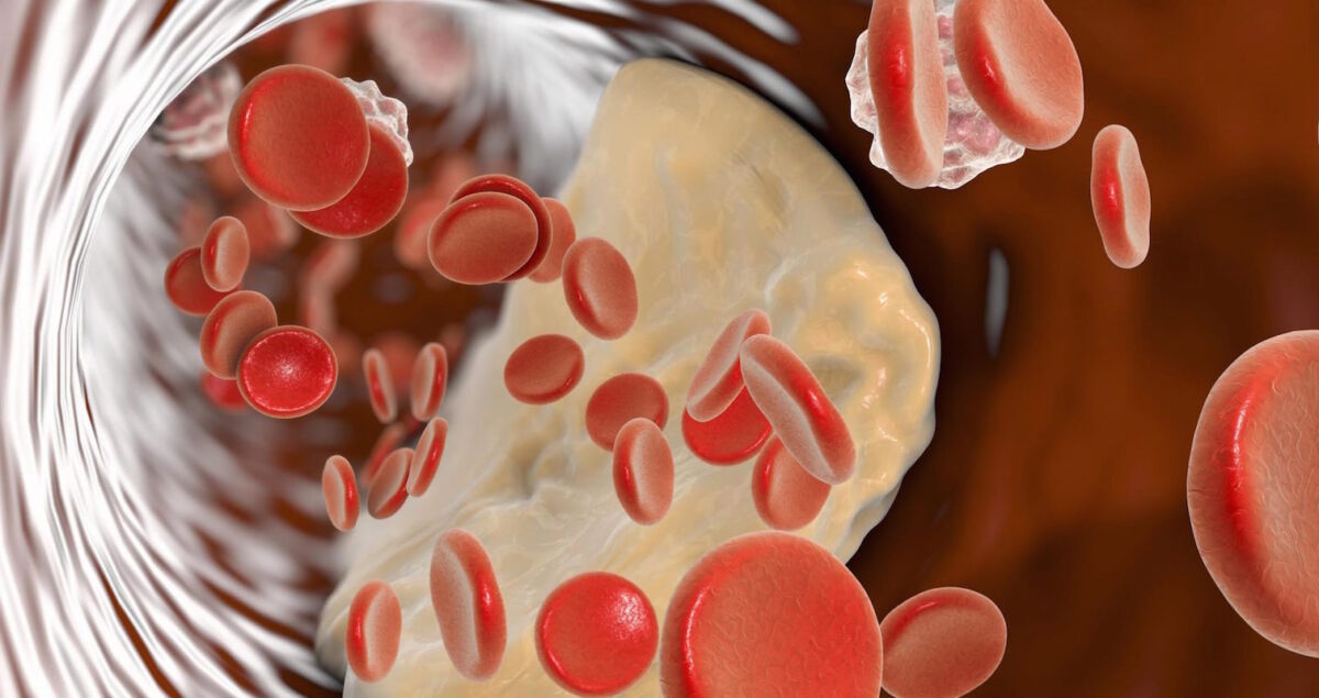 ¡El ‘menú’ pa’ la buena salud! La Asociación Americana del Corazón (AHA) acaba de actualizar su guía de recomendaciones dietéticas para preservar la salud cardiovascular. Deja muy claro cuál es el “menú diario” a seguir para evitar el infarto y otras enfermedades cardiovasculares, según los resultados de las investigaciones más recientes.