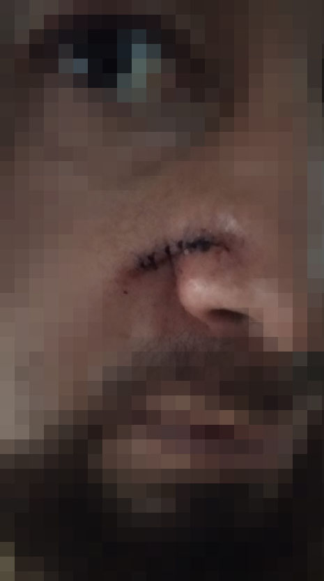 EN VIDEO: Salvaje agresión de hinchas en una tienda de Teusaquillo Recientemente se conoció un nuevo hecho violento protagonizado por supuestos hinchas. Resulta que estas personas ingresaron a un establecimiento comercial en Teusaquillo y de manera violenta agredieron a los clientes, además de hurtarles varias de sus pertenencias.