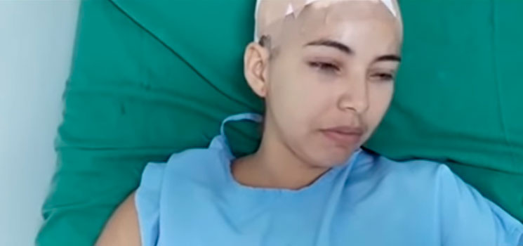Condenarán a hombre por haberle arrancado el cuero cabelludo a su pareja para que nadie se fijara en ella 1 Condenarán a hombre por haberle arrancado el cuero cabelludo a su pareja para que nadie se fijara en ella A este sujeto lo juzgan por hechos ocurridos en el 2018 que impactaron al país, ya que este hombre tomó un cuchillo para quitarle parte del cuero cabelludo a su pareja en medio de una pelea.