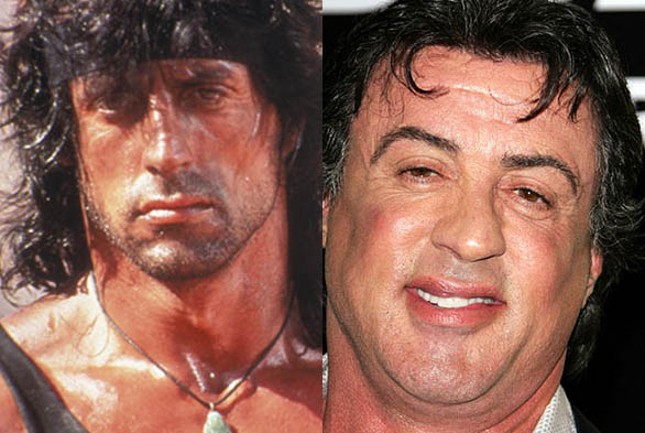 Famosos que han abusado de la cirugías y el bótox 2 Famosos que han abusado de la cirugías y el bótox No hay que tener cinco dedos de frente para notar que Madonna se hizo retoques en su rostro. Más allá de que le parezcan bien o mal, esto causó polémica en redes sociales, pues se le evidencian bastante el cambio, tanto que no parece que fuera la cantante de 63 años. Muchos dicen que su adicción a la cirugía plástica y al bótox la está deformando, al punto de dejarla irreconosible.