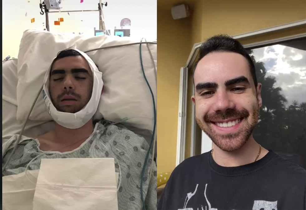 Pasó de ser el 'patito feo' a galán de TikTok Hunter David se volvió viral en una red social, tras compartir en su cuenta el proceso que vivió para poder cambiar su aspecto físico al someterse a nueve cirugías plásticas, que lo catapultaron como el nuevo galán de TikTok