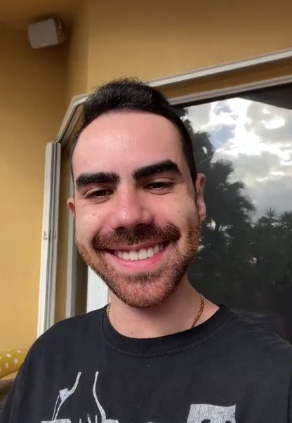 Pasó de ser el 'patito feo' a galán de TikTok 4 Pasó de ser el 'patito feo' a galán de TikTok Hunter David se volvió viral en una red social, tras compartir en su cuenta el proceso que vivió para poder cambiar su aspecto físico al someterse a nueve cirugías plásticas, que lo catapultaron como el nuevo galán de TikTok