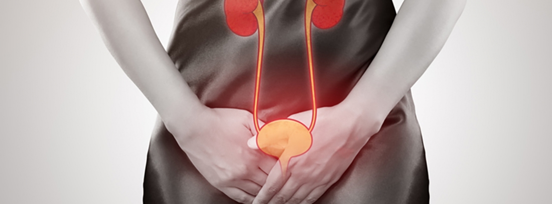 La cistitis puede generar problemas en los riñones Cistitis es el término médico para definir la inflamación de la vejiga. La mayoría de las veces la inflamación es causada por una infección bacteriana y se llama infección urinaria. Una infección en la vejiga puede ser dolorosa y molesta, y puede convertirse en un problema de salud grave si la infección se disemina a los riñones.