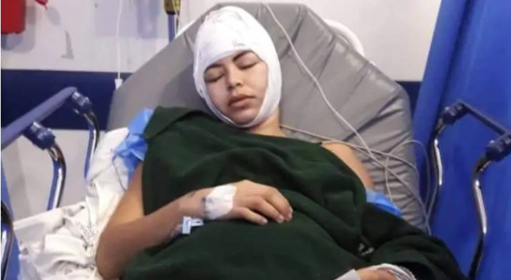 Condenarán a hombre por haberle arrancado el cuero cabelludo a su pareja para que nadie se fijara en ella A este sujeto lo juzgan por hechos ocurridos en el 2018 que impactaron al país, ya que este hombre tomó un cuchillo para quitarle parte del cuero cabelludo a su pareja en medio de una pelea. 